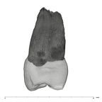 UW101-1004 Homo naledi UP mesial