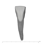 UW101-1005A Homo naledi LLI1 labial