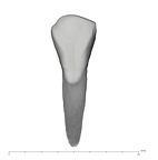 UW101-1005C Homo naledi LRI2 labial