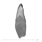UW101-1005C Homo naledi LRI2 mesial