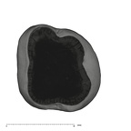 UW101-1006 Homo naledi URM2 apical