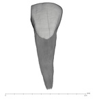 UW101-1012 Homo naledi URI1 labial