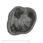 UW101-1063 Homo naledi ULM germ apical