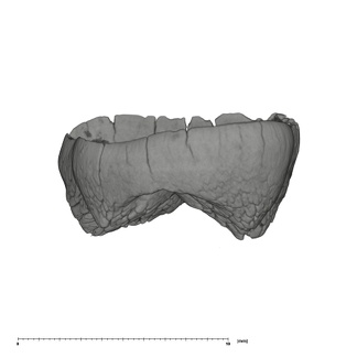 UW101-1063 Homo naledi ULM germ distal