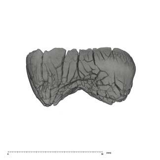 UW101-1063 Homo naledi ULM germ mesial