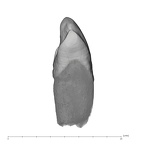 UW101-1076 Homo naledi LLC mesial