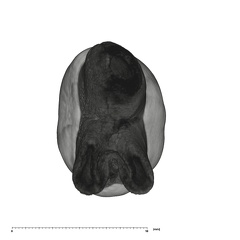 UW101-1107 Homo naledi UP apical