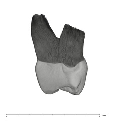 UW101-1107 Homo naledi UP mesial