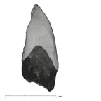 UW101-1126 Homo naledi LLC distal