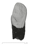 UW101-1126 Homo naledi LLC lingual