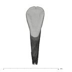 UW101-1131 Homo naledi LLI2 lingual