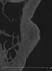 UW101-1142 Homo naledi hide osteoma 2
