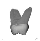 UW101-1269 Homo naledi ULM3 distal