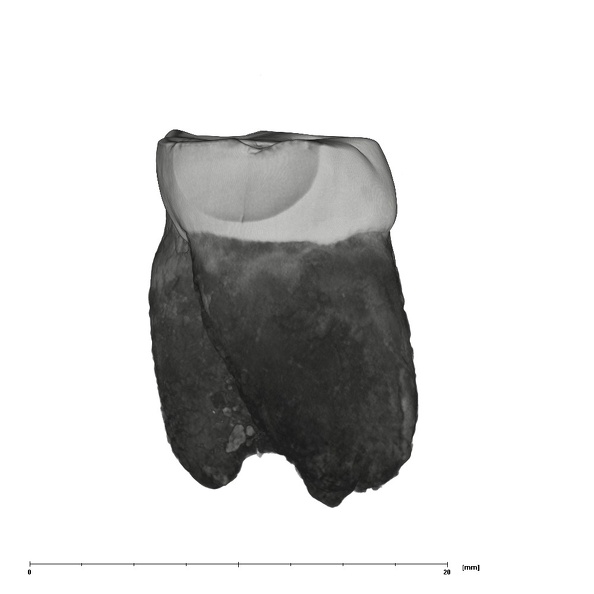 UW101-1287B Homo naledi LRM1 distal