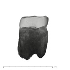 UW101-1287B Homo naledi LRM1 mesial