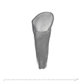 UW101-1304 Homo naledi ULDI2 labial