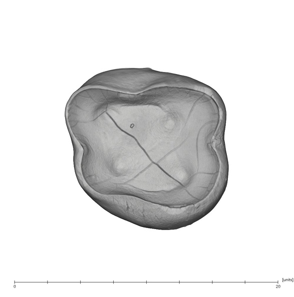 UW101-1305 Homo naledi ULM1 apical