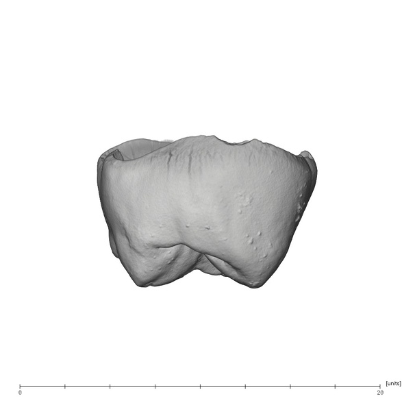 UW101-1305 Homo naledi ULM1 distal