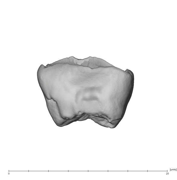 UW101-1305 Homo naledi ULM1 mesial