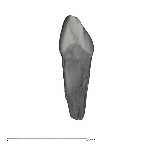 UW101-1331 Homo naledi ULDI1 distal