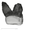 UW101-1396 Homo naledi URM1 distal