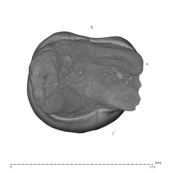 UW101-1398A Homo naledi URM3 apical