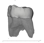 UW101-1398A Homo naledi URM3 distal