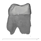 UW101-1398A Homo naledi URM3 mesial