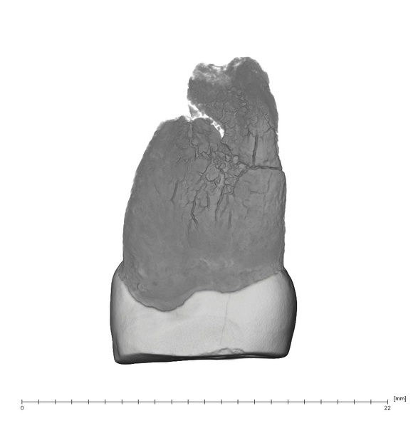 UW101-1401 Homo naledi URP4 distal