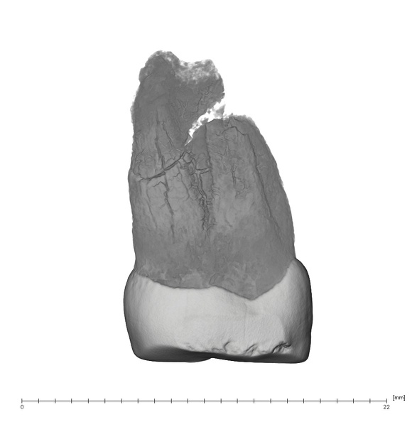 UW101-1401 Homo naledi URP4 mesial