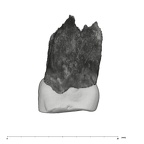 UW101-1402 Homo naledi URP3 mesial