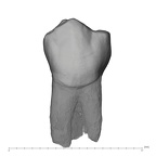 UW101-144 Homo naledi LLP3 buccal