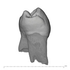 UW101-144 Homo naledi LLP3 mesial