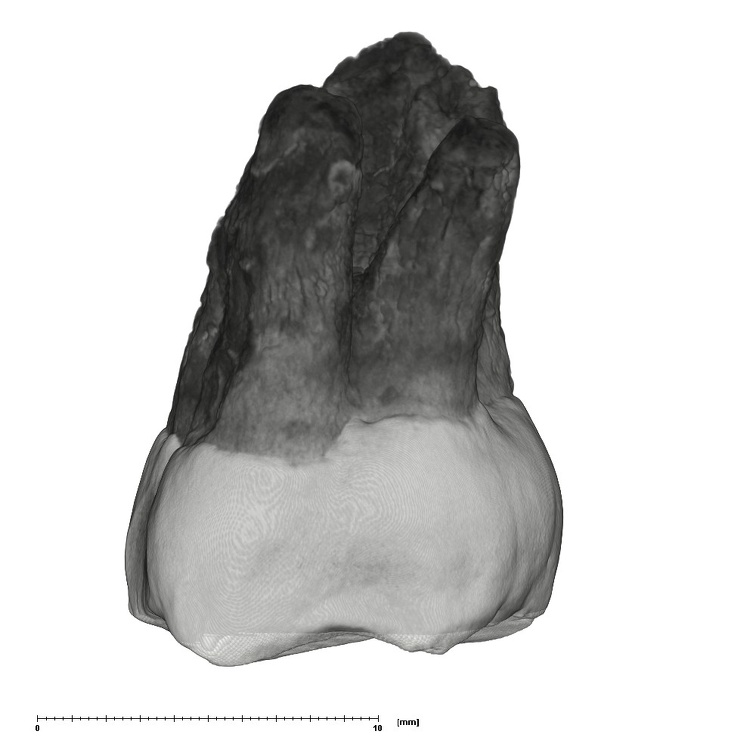 UW101-1471 Homo naledi ULM3 buccal