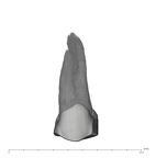 UW101-1561 Homo naledi ULP4 buccal