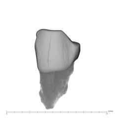 UW101-1571 Homo naledi LLDC labial
