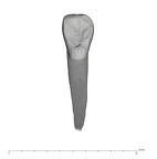 UW101-1588 Homo naledi ULI2 lingual