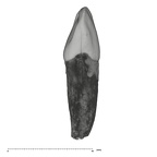UW101-1612 Homo naledi LRDI2 mesial