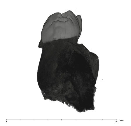 UW101-1685 Homo naledi LRDM1 mesial