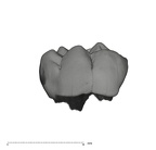 UW101-1686 Homo naledi LRMD2 crown buccal