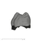 UW101-1686 Homo naledi LRMD2 crown mesial