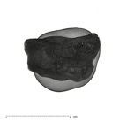 UW101-1687 Homo naledi URDM2 apical