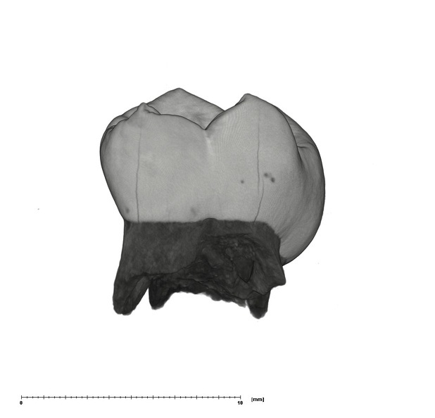 UW101-1687 Homo naledi URDM2 buccal