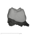 UW101-1687 Homo naledi URDM2 distal