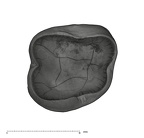 UW101-1688 Homo naledi URM1 apical