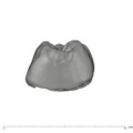 UW101-1689 Homo naledi LRM1 mesial