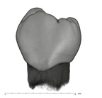 UW101-184 Homo naledi LLP4 buccal