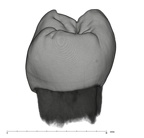 UW101-184 Homo naledi LLP4 distal