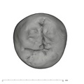 UW101-184 Homo naledi LLP4 occlusal
