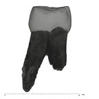 UW101-277 Homo naledi ULP4 mesial